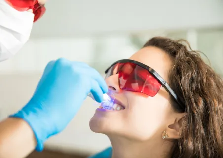 Mulher fazendo clareamento dental 