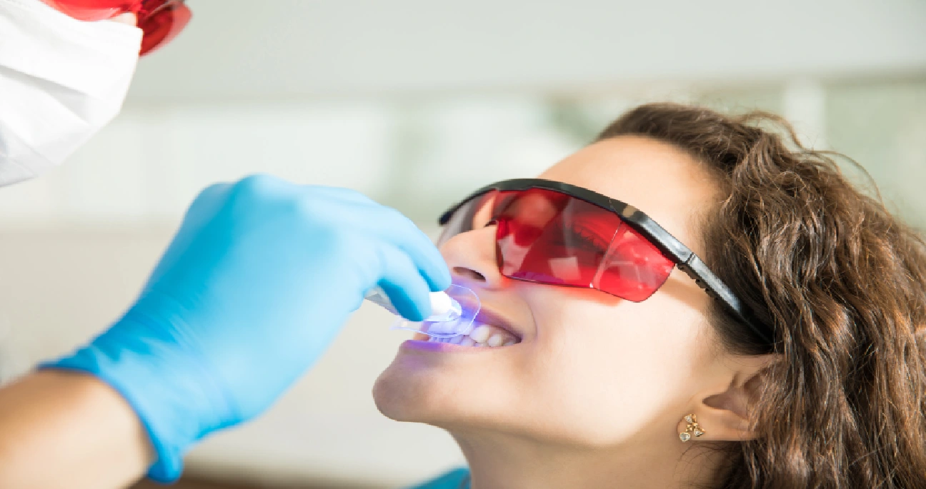 Mulher fazendo clareamento dental 